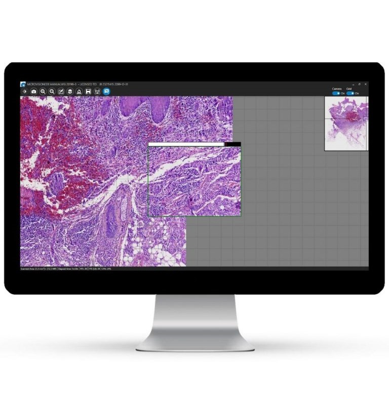 Skanowanie manualne – Microvisioneer mvSlide